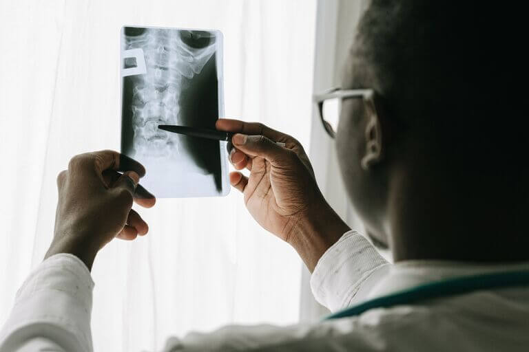 médecin visualisant une rémission spondylarthrite